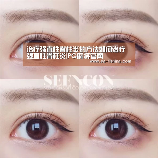 治疗强直性脊柱炎的方法如何治疗强直性脊柱炎|PG麻将官网